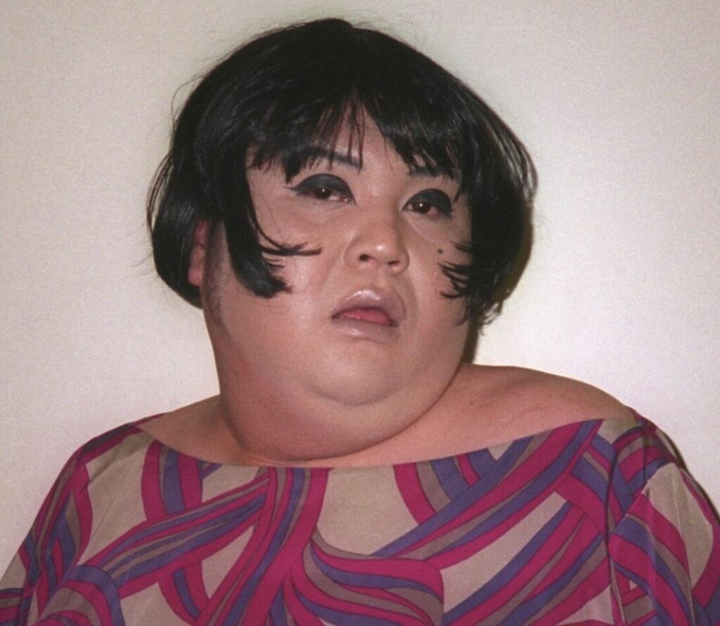 マツコデラックスの病気